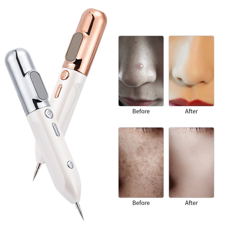 Plasma Hautverjüngungsstift - GlowLift
