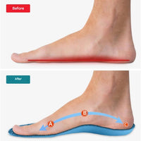 Orthopädische Einlegesohlen – StepRelief