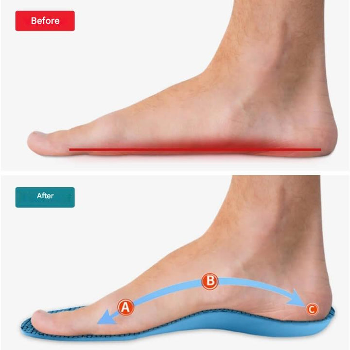 Orthopädische Einlegesohlen – StepRelief