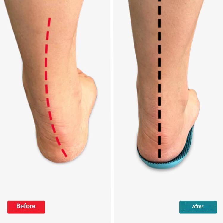Orthopädische Einlegesohlen – StepRelief