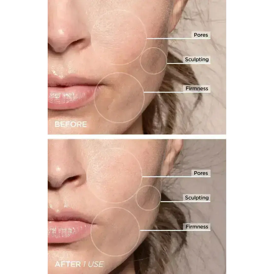 7-in-1 LED Gesichtsstraffungs- & Massagetool – Vénera