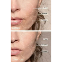 7-in-1 LED Gesichtsstraffungs- & Massagetool – Vénera
