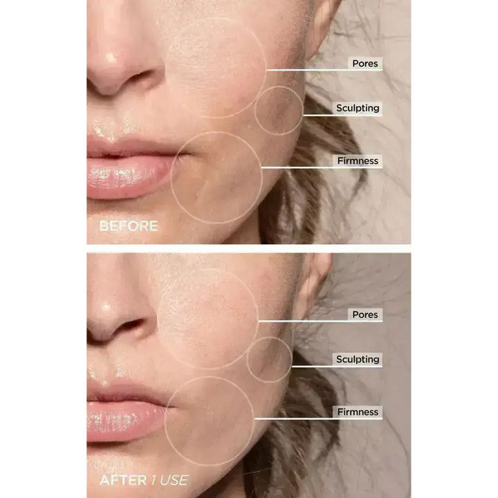 7-in-1 LED Gesichtsstraffungs- & Massagetool – Vénera